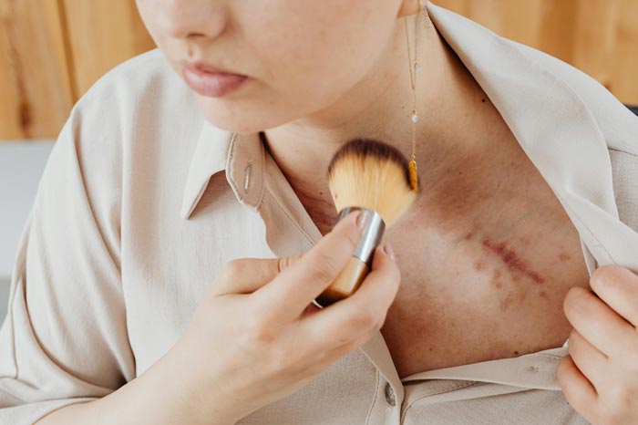 봄철 황사와 피부 트러블 예방 방법